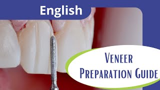 Veneer preparation guide [upl. by Rowen]