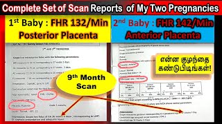 How to Find Baby Gender using Scan Reports in Tamil  Placenta  Fetal Heart Rate  Boy or Girl [upl. by Ehtylb]