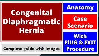 Congenital Diaphragmatic Hernia made easy mbbs newbornneonatology neetpg pediatrics cdh [upl. by Neeloc430]