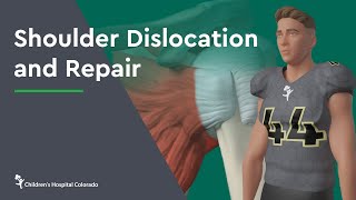 Shoulder Dislocation and Repair [upl. by Steel348]