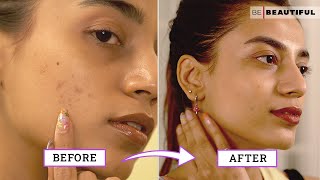 How To Improve Your Skin Texture  Skincare Tips For Bumpy Skin  Be Beautiful [upl. by Wanfried]