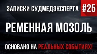 Записки Судмедэксперта 25 quotРеменная Мозольquot Страшные Истории на реальных событиях [upl. by Bray700]