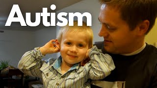 12 Signs of Autism in a 2yearold [upl. by Aaron905]