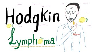 Hodgkin’s lymphoma  Hodgkin’s Disease  ReedSternberg Cell  Hematology and Oncology [upl. by Ecirtaeb]