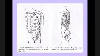 Precordium Palpation Percussion [upl. by Yhtac]