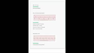 Relias Dysrhythmia Basic A Questions amp Answers All Correct amp Verified [upl. by Mutat755]