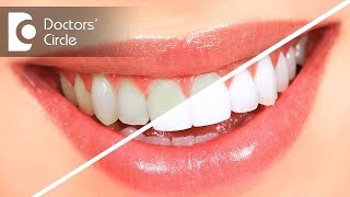 Teeth cleaning vs teeth whitening  Dr Sumanth M Shetty [upl. by Serafine]