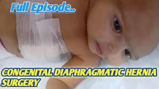 Newborn Vlog Congenital Diaphragmatic Hernia Surgerynewbornbabynewlyborn viralshortsviralvideo [upl. by Niarbo352]