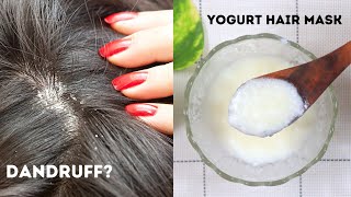 Yogurt Hair Mask  Dandruff Removal Treatment at Home  Yogurt For Dandruff [upl. by Berkeley]