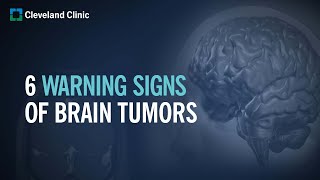 6 Warning Signs of Brain Tumors [upl. by Klute83]