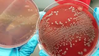 Microbiology Urine Culture Primary SetUp Inoculation and Colony Count [upl. by Seaman]