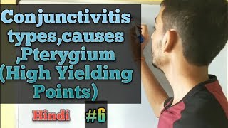 Conjunctiva anatomyConjunctivitishindi Pterygium vs Pinguecula Ophthalmology lectures in hindi [upl. by Soni]