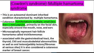 Squamous cell papilloma EVERYTHING you need to knowEtiologyclinical features histopath treatment [upl. by Oniluap]