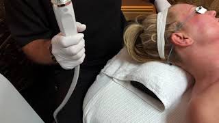 Rick McCoy explains the EndyMed 3Deep RF Microneedling skin tightening treatment at Cascades MedSpa [upl. by Assetniuq359]