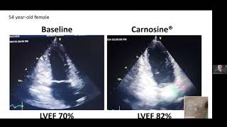 How Carnosine Benefits the Heart [upl. by Legnaesoj]