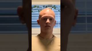 HELIKOPTER HELIKOPTER 🚁🚁 comedy funny lol alopecia [upl. by Enialedam242]