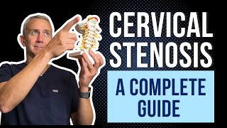 Cervical Spine Stenosis  A Complete Guide [upl. by Nefets]