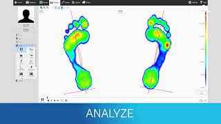 Create Custom Orthotics with a Digital Workflow  Materialise Phits Suite [upl. by Manthei]