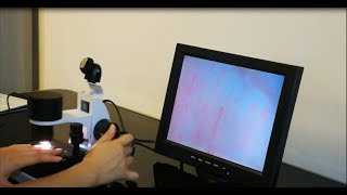 microcirculation microscope machine operation and test video [upl. by Airdnas742]