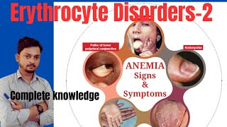 Anemia Aplastic Anemia Iron amp vitamin b12 anemia signs symptoms trending viralvideo [upl. by Winnie]