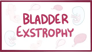 Bladder exstrophy  causes symptoms diagnosis treatment pathology [upl. by Wagstaff]