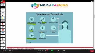 Sarcoidosis  Respiratory Medicine  UrduHindi [upl. by Antipas]