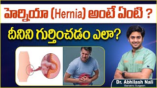 What Is Hernia In Telugu  Hernia Symptoms In Telugu  Hernia Near Belly Button  Dr Abhilash Nali [upl. by Atikehs130]