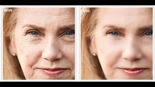 BEST ANTIAGING CREAM  AFFORDABLE  Revitol AntiAging Cream [upl. by Seldon370]