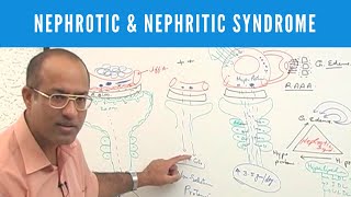 Nephrotic and Nephritic Syndrome  Causes Symptoms amp Treatment🩺 [upl. by Yanal]