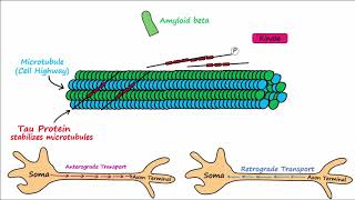 Alzheimers Disease  plaques tangles pathogenesis risk factors disease progression [upl. by Searby]