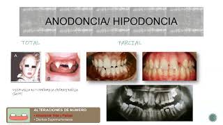 Clase Anomalías Dentarias Congénitas y Adquiridas 2022 [upl. by Yokoyama]