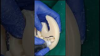 HIPC full arch dental implant bridges sectioning from milled blanks shorts [upl. by Nivets]