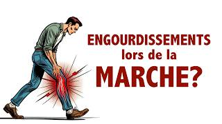 Des engourdissements lors de la MARCHE Infos et conseils [upl. by Lakim]