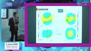 Dépistage précoce du kératocône  présentation du logiciel Score Analyzer [upl. by Ettenna]