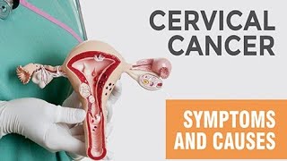 cervical cancer cancer mbbs doctor cervicalcancersymptoms medical medicalstudent [upl. by Linder222]