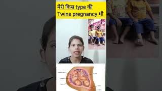 meri kis type ki twins pregnancy thi dichorionic diamniotic twins pregnancy ka kya matlab hota hai [upl. by Masterson180]