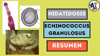 HIDATIDOSIS  ECHINOCOCCUS GRANULOSUS RESUMEN [upl. by Aseneg]