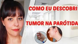 Como eu descobri meu tumor de parótida glândula salivar [upl. by Steffi]