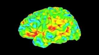 Resting state brain scans give diagnosis by default [upl. by Belak]