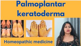 Palmoplantar keratoderma treatment  Palmoplantar keratoderma symptomscauses amp homeopathic medicine [upl. by Bass800]