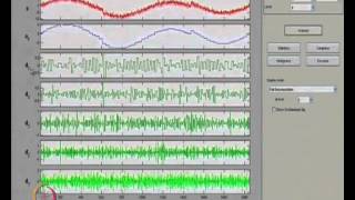 Mod01 Lec50 Wavelet Applications [upl. by Izak]