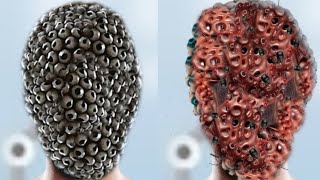 ASMR Trypophobia amp Maggots Removal  ASMR 2D Animation Treatment [upl. by Cost]