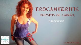 Trocanteritis o bursitis de cadera Ejercicios y tratamiento para disminuir el dolor [upl. by Hercules]