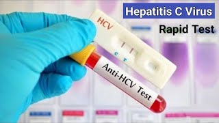 Hepatitis C Rapid Test  কিভাবে হেপাটাইটিসসি ভাইরাস পরীক্ষা করা হয়  AntiHCV RDT Test [upl. by Ahsykal387]