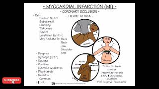 Myocardial infarction [upl. by Alad]