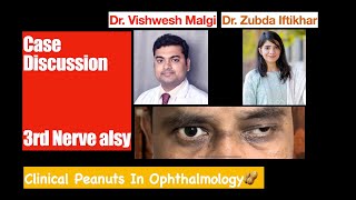 case Discussion  Oculomotor Third Nerve Palsy [upl. by Ynnahc]