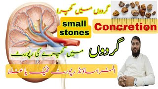 Concretion in kidneys  Ultrasound KUB Urdu Hindi  stones report  Gurdo me kachra  Gurdo me pathr [upl. by Pelletier]