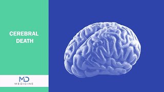 Cerebral Death  Symptoms Diagnosis and Treatment  mdmedicinenetwork [upl. by Aisatana]