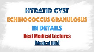 Hydatid cyst of Echinococcus granulosusDog tapeworm  Discussed in details everything you need [upl. by Imhskal]