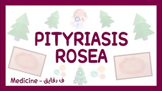 Pityriasis rosea  definition clinical picture diagnosis amp treatment شرح عربي [upl. by Hnaht791]